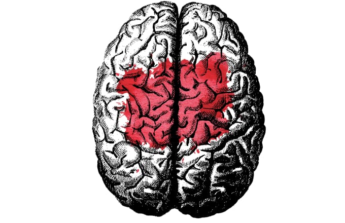 Teste simples ajuda a rastrear o Alzheimer em três minutos